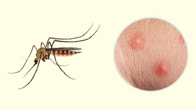 Identifikasi Bahaya dan Penanganan Jenis Gigitan Serangga